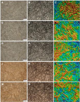 Inspired by nature: Fiber networks functionalized with tannic acid and condensed tannin-rich extracts of Norway spruce bark show antimicrobial efficacy